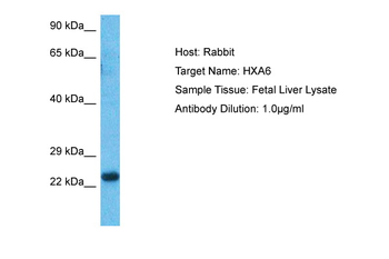 HOXA6 Rabbit Polyclonal Antibody