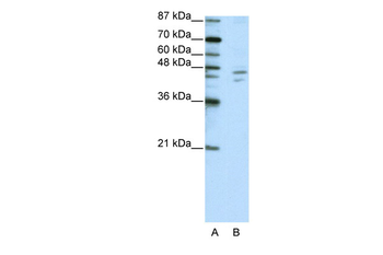 ZNF419A Rabbit Polyclonal Antibody