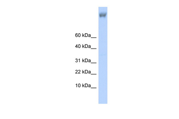 ZNF644 Rabbit Polyclonal Antibody