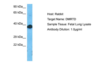 DMRTC2 Rabbit Polyclonal Antibody