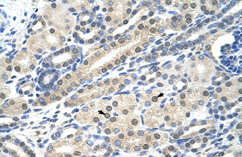 BTBD14B Rabbit Polyclonal Antibody