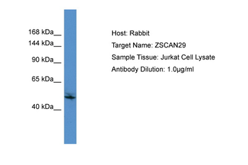 ZSCAN29 Rabbit Polyclonal Antibody