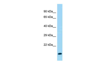 ZFP660 Rabbit Polyclonal Antibody