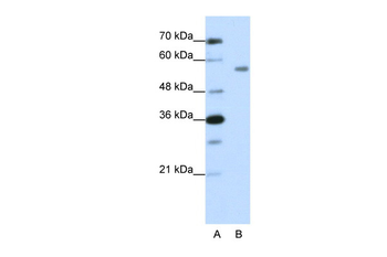 ZNF497 Rabbit Polyclonal Antibody
