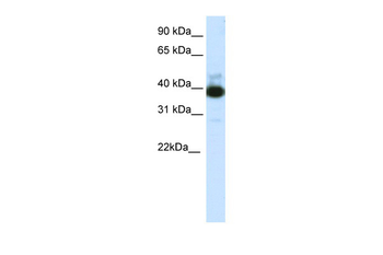 TTC19 Rabbit Polyclonal Antibody