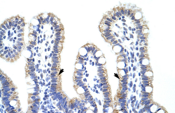 EXOSC10 Rabbit Polyclonal Antibody