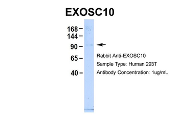 EXOSC10 Rabbit Polyclonal Antibody