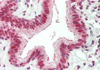 EXOSC10 Rabbit Polyclonal Antibody