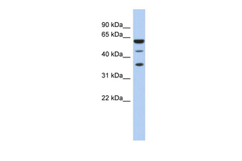 RDBP Rabbit Polyclonal Antibody