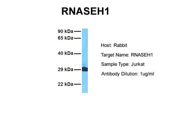 RNASEH1 Rabbit Polyclonal Antibody