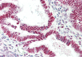 RNASEH1 Rabbit Polyclonal Antibody