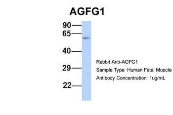 HRB Rabbit Polyclonal Antibody