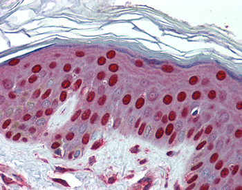 NCL Rabbit Polyclonal Antibody