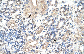 NCL Rabbit Polyclonal Antibody