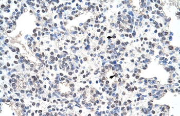 NCL Rabbit Polyclonal Antibody
