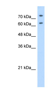 NCL Rabbit Polyclonal Antibody