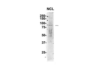 NCL Rabbit Polyclonal Antibody