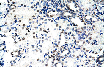NCL Rabbit Polyclonal Antibody