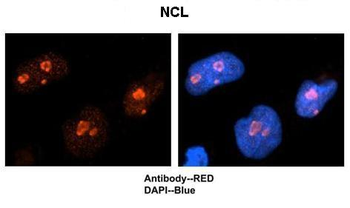 NCL Rabbit Polyclonal Antibody