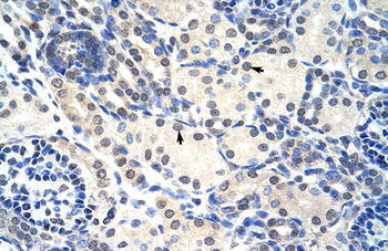 RNASEH2A Rabbit Polyclonal Antibody