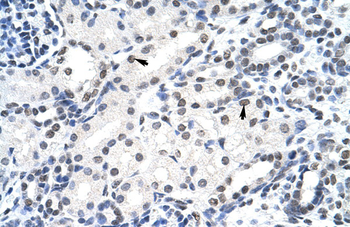 SURF6 Rabbit Polyclonal Antibody