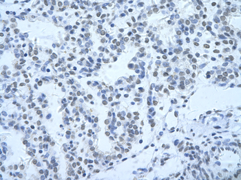HNRPH3 Rabbit Polyclonal Antibody