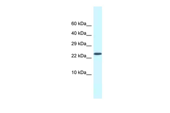 Csdc2 Rabbit Polyclonal Antibody