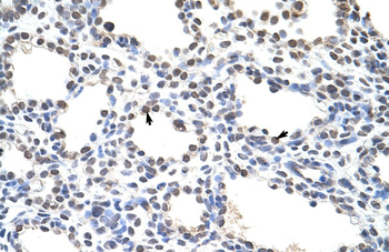 CSDC2 Rabbit Polyclonal Antibody