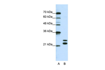 CSDC2 Rabbit Polyclonal Antibody