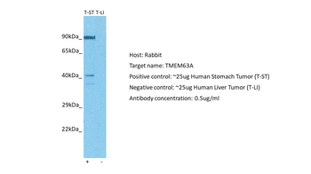 TMEM63A Rabbit Polyclonal Antibody