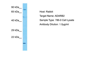 ADARB2 Rabbit Polyclonal Antibody