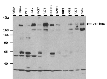 TNRC6A Rabbit Polyclonal Antibody