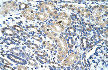 WBSCR1 Rabbit Polyclonal Antibody
