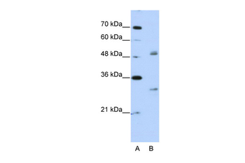 WBSCR1 Rabbit Polyclonal Antibody