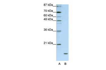 FAM121B Rabbit Polyclonal Antibody