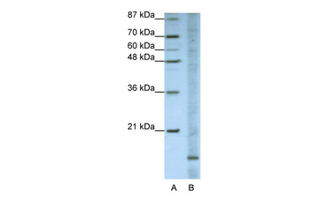 FAM121B Rabbit Polyclonal Antibody
