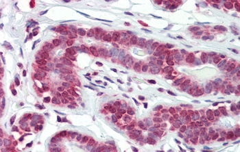BXDC5 Rabbit Polyclonal Antibody