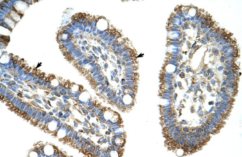 MGC42174 Rabbit Polyclonal Antibody