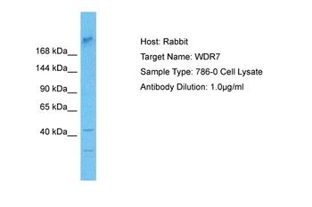 WDR7 Rabbit Polyclonal Antibody
