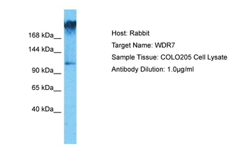 WDR7 Rabbit Polyclonal Antibody