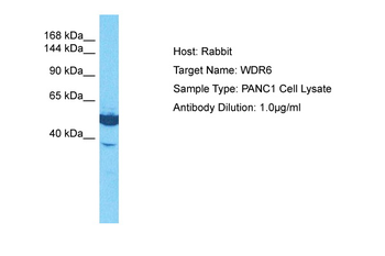 WDR6 Rabbit Polyclonal Antibody