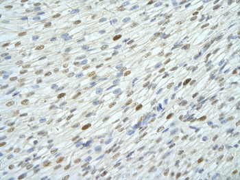 WDR6 Rabbit Polyclonal Antibody