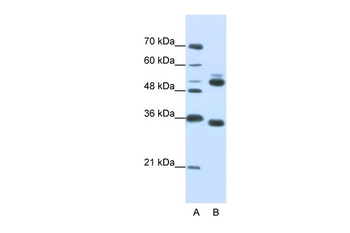 WDR6 Rabbit Polyclonal Antibody