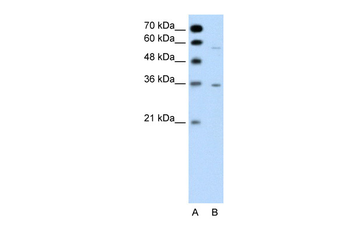 GPCR5A Rabbit Polyclonal Antibody