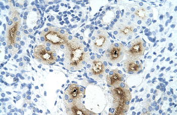 GGTLA4 Rabbit Polyclonal Antibody