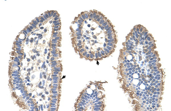 KRT2A Rabbit Polyclonal Antibody