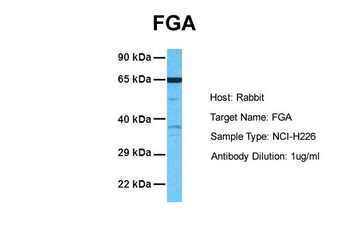 FGA Rabbit Polyclonal Antibody