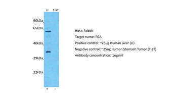 FGA Rabbit Polyclonal Antibody