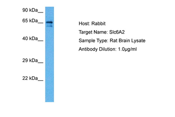 SLC6A2 Rabbit Polyclonal Antibody