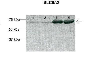 SLC6A2 Rabbit Polyclonal Antibody